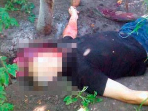 В Харькове мужчина распилил себя «болгаркой»