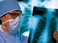 Ситуация с туберкулезом в Харькове и области: последние данные