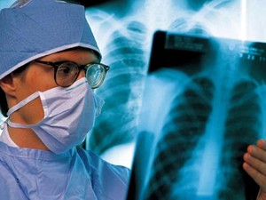 Ситуация с туберкулезом в Харькове и области: последние данные
