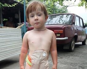 Фермер из Змиевского района оплатил девочке из семьи переселенцев лечение