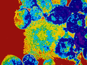 Обнаружены новые гигантские вирусы — с двойной защитой