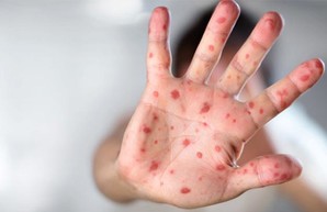 Харьковчан стали чаще атаковать инфекции