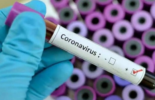 Кернес рассказал, когда в Харьков прибудут тесты на коронавирус
