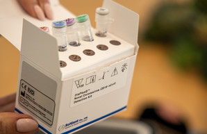 За сутки на Харьковщине диагноз COVID-19 подтвержден у 390 человек