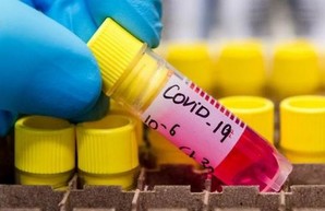 Диагноз COVID-19 подтвержден у 712 жителей Харьковщины