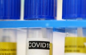 COVID-19 подтвердили у 556 жителей Харьковской области