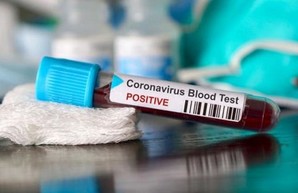За сутки диагноз COVID-19 подтвердили у 803 жителей Харьковщины