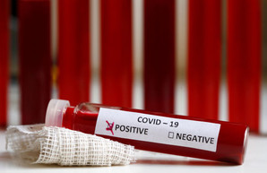 Украина – в мировых лидерах по новым случаям инфицирования COVID-19
