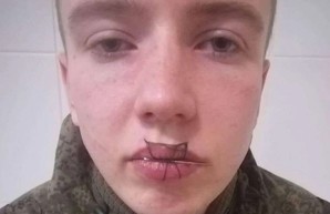 В России солдат зашил себе рот ниткой после ссоры с девушкой